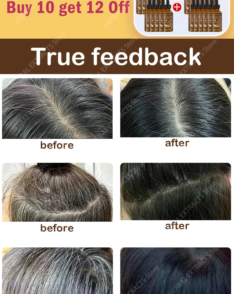 Description Picture 3 of itemAnti Gray Hair Serum White Darkening Natural Hair Color