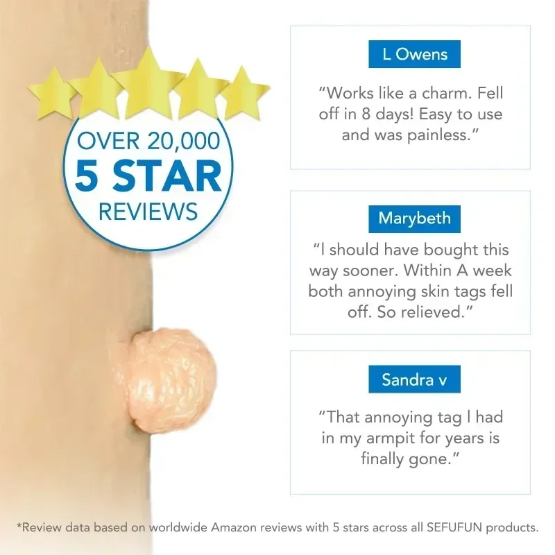 Skin Tag Removal Tool Simple Wart Removal Tool Set Easy To Clean