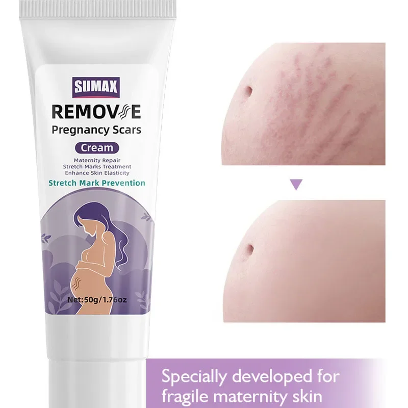 

Remove Stretch Mark Cream Postpartum Obesity Pregnant Women Repair Pregnancy Scars Anti-Winkles Firming Maternity Body skin care