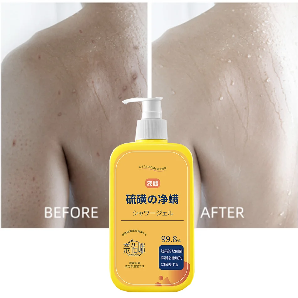 Shower Gel 400ml Sulfur Liquid Mite Removal Soap Cleaner Bar Soap Acne Treatment Reduce Oil Keeps Pores Cleaner Hand Sulfur body wash