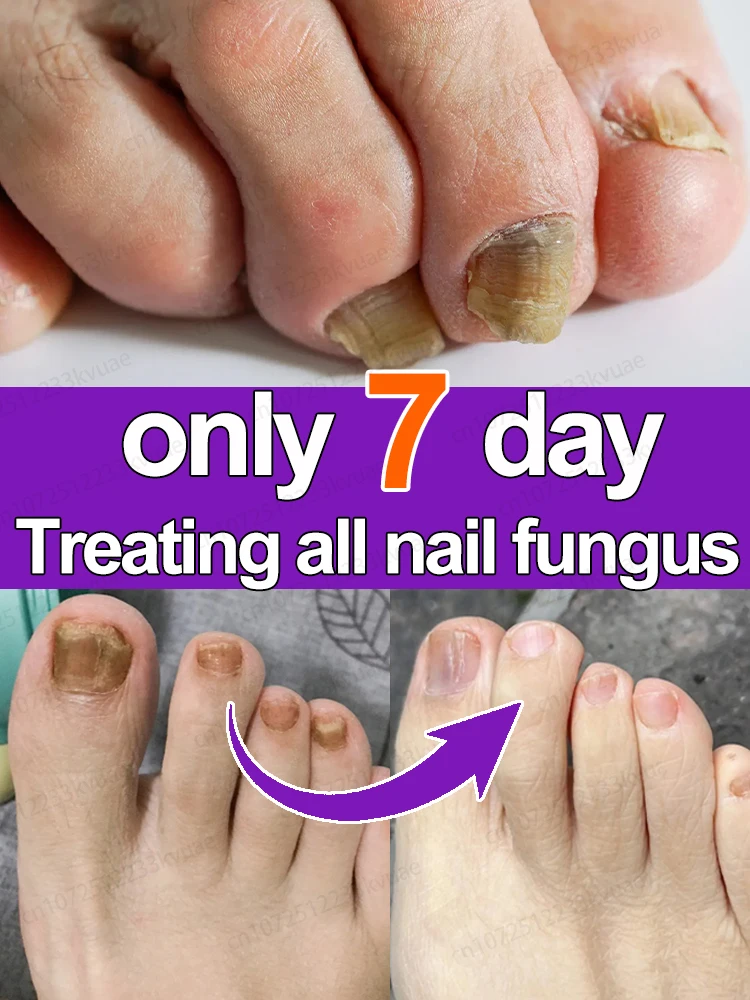 Organic Essential Oil Foot Serum 7-Day Repair