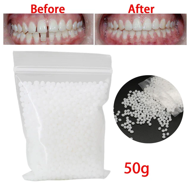 50g/100g Temporary Tooth Repair kit for Fix Filling the Missing Broken  Tooth and Gaps, Moldable Fake Teeth Veneers and Thermal Beads Replacement  Kit, Artificial Teeth 