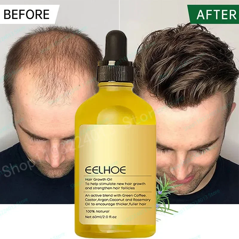 

Hair Growth Essential Oil Hair Strengthening Oil Nourishing Treatment for Split Ends Organics Hair