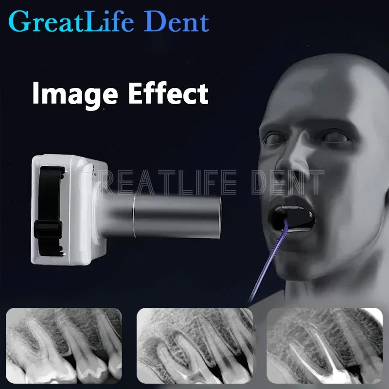 GreatLife Dent Original APS CMOS IP68 Waterproof Digital Dental X Ray Sensor Dental Runyes TWAIN Driver Rvg X-Ray Sensor Image