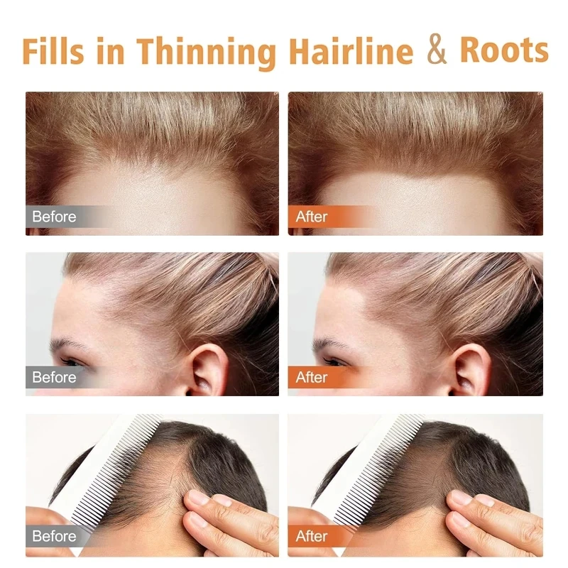 Elevate Hair Line Powder Instantly Conceal Hair Loss For Thinning Area – Elevate Hair Inc