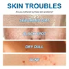 Oligopeptide Anti Acne Face Serum EGF Acne Treatment Essence Diminish Pigmentation Moisturizing Skincare Repair Skin Barrier 6