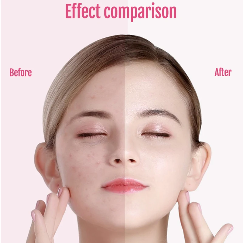 Ultrasonic Skin Scrubber Deep Facial Cleanser Acne Blackhead Remover Peeling Cavitation Beauty Instrument