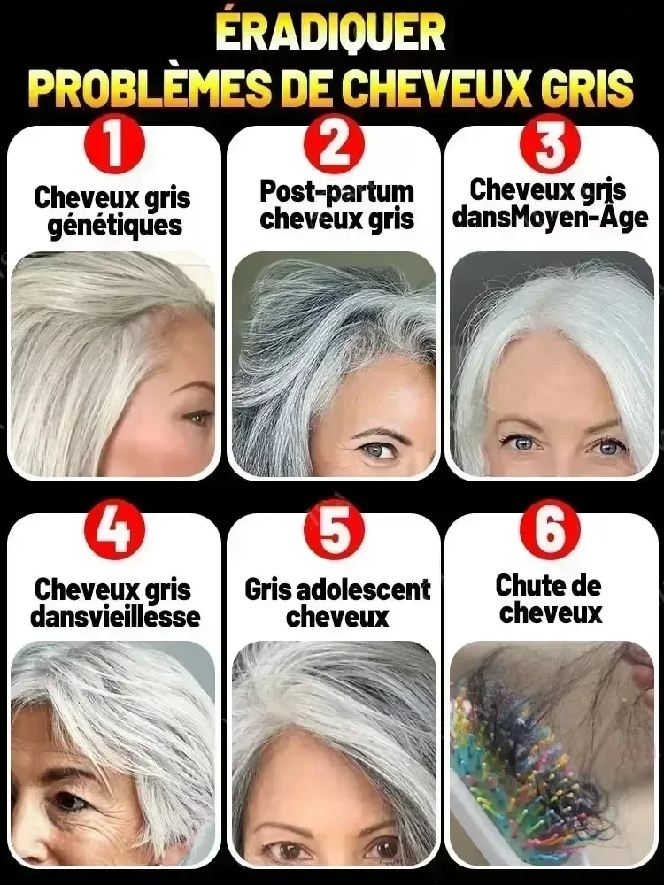 Hair Treatment Turn White Hair into Black Remove Gray Hair in 7 Days