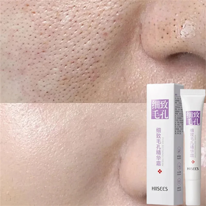 

Salicylic Acid Pore Shrinking Cream Quick Elimination Large Pores Remove Blackehead Tighten Face Smooth Skin Korean Care Product