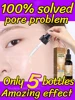Large pores problem 1