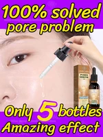 Large pores problem 1
