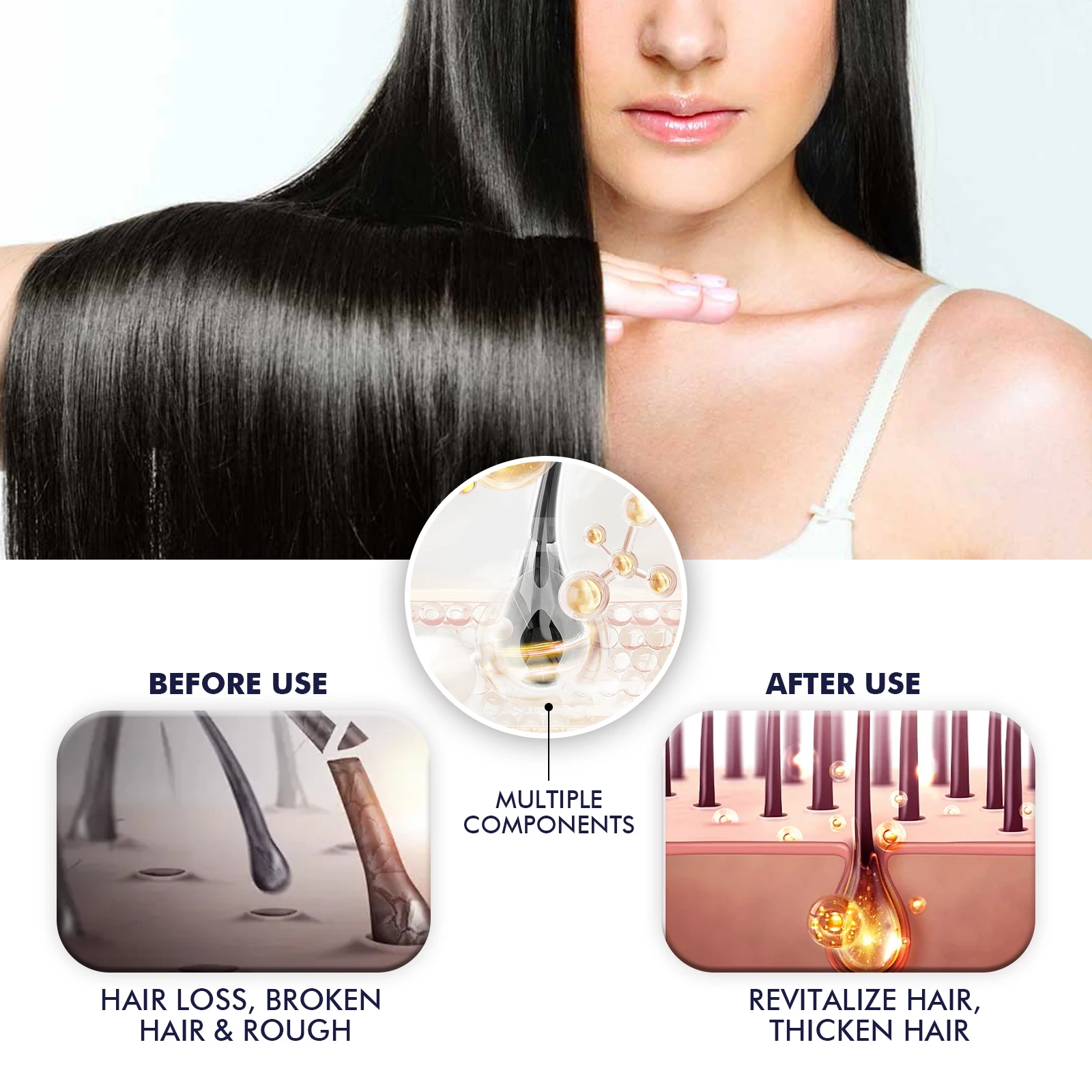 Hair Growth Spray Prevent Baldness Treatment Scalp Dry Damaged Split Hair Dense Strengthen Nourishing Smoothing Massage Liquid