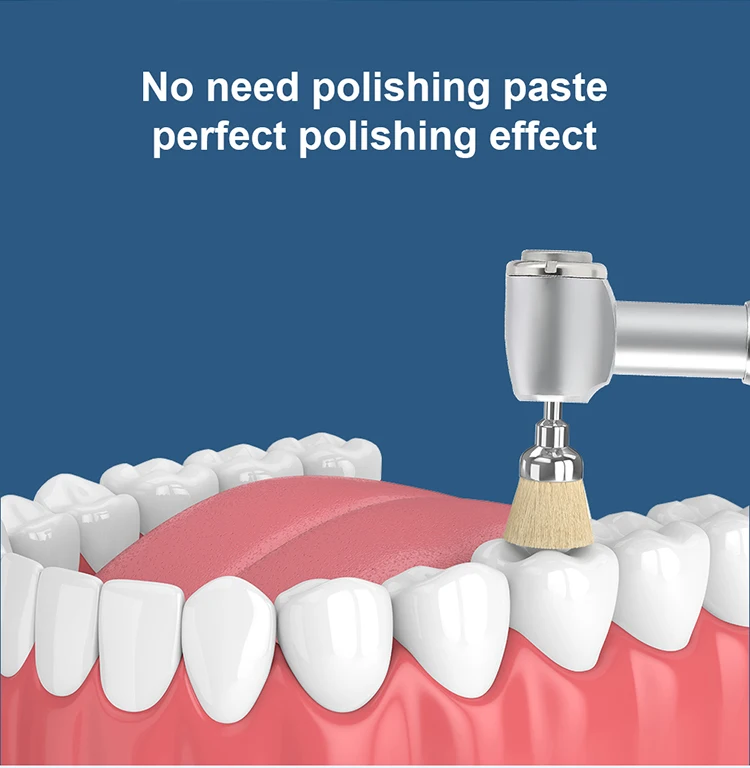 10 Stück AZDENT Dental-Polierbürsten aus Aluminiumoxid und Siliziumkarbid, Flache Scharfe Schalenform, Prophylaxe-Polierer für Winkelstücke – Detail 32