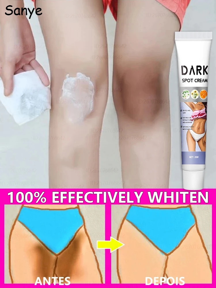 Removing Dark Knuckles Serum Hands Whitening Intimate Areas Cream Underarm Elbow Knee Private Parts Remove Melanin Whiten Cream