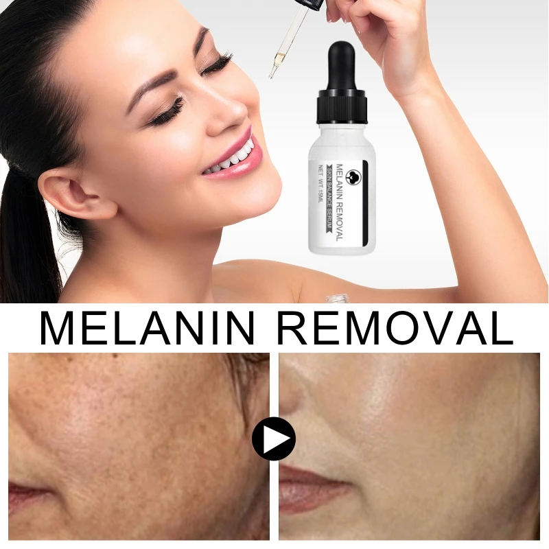 

Niacinamide Dark Spots Remover Serum Freckle Whitening Moisture Powerful Removal Black Dot Melasma Chloasma Face Skin Care Cream