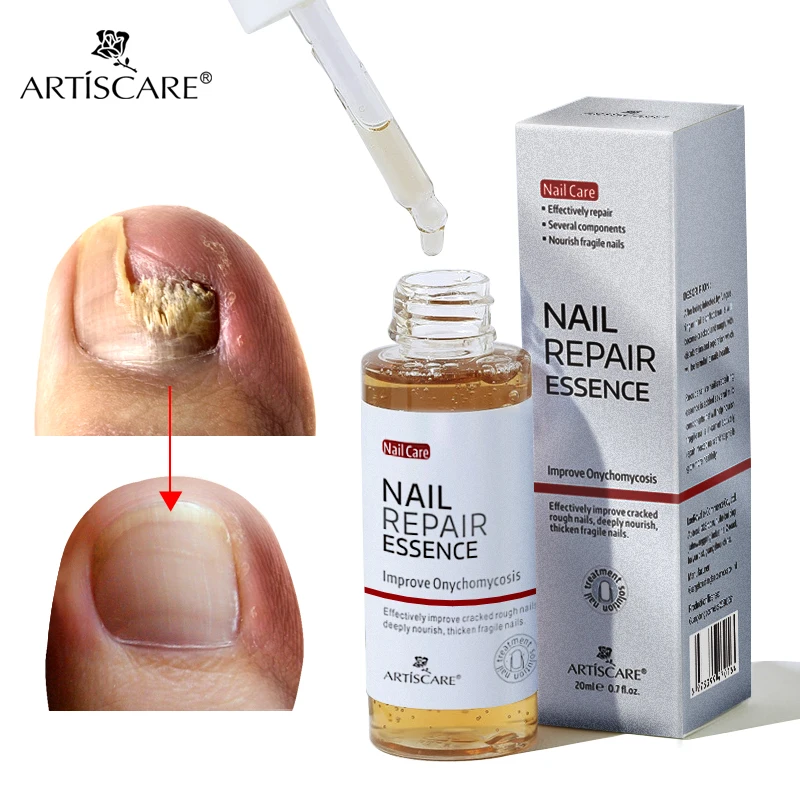 Nail Care Kit ARTISCARE Nail Care Essence Feet Care Nail Serum 20mL