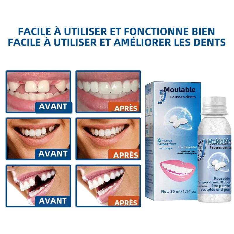 Kit De Prothèses Dentaires Temporaires En Silicone - Pour Embellissement Et Confort Immédiat