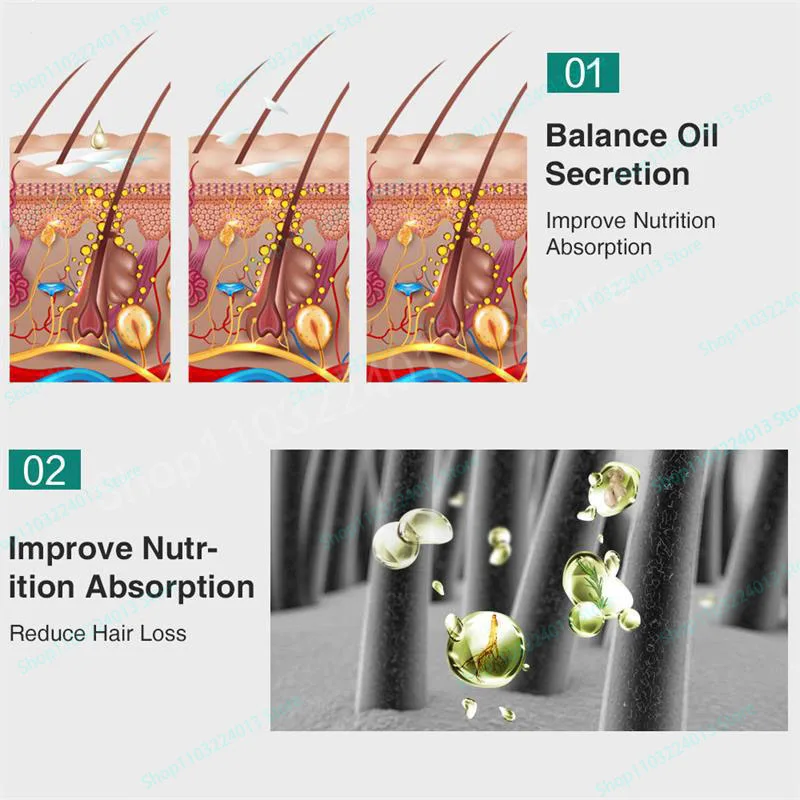 Description Picture 6 of itemNatural Ginger Hair Growth Spray Hair Roots Fast Grow Anti Hair Loss Serum Liquid Scalp Damaged Treatment Repair Beauty Health