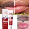 Remove Dark Lip Balm Fast Lightening Pink Lip Exfoliating Fade Lip Line Dead Skin Moisturizer Korean Care Products Beauty Health 2