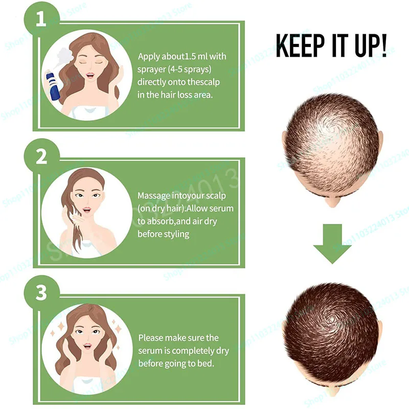 Description Picture 5 of itemNatural Ginger Hair Growth Spray Hair Roots Fast Grow Anti Hair Loss Serum Liquid Scalp Damaged Treatment Repair Beauty Health