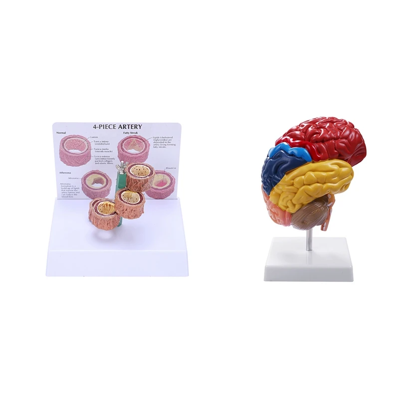 

NEW-1 Pcs Vascular Pathology Model & 1 Pcs Half Brain Brainstem Teaching Model