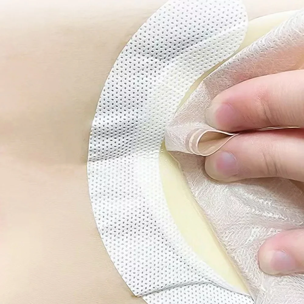 20pcs/lot Portable Ostomy Care Fix Tape Spunlaced Tapes To Fix Your Colostomy Bags Prevent Flange From Warping and Shifting 3