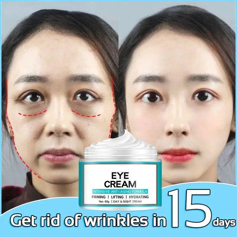 Advanced retinol eye cream lightens dark circles and fine lines, removes eye bags, anti wrinkle, anti-aging