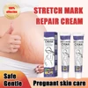 Stretch Mark Repair Cream – Smooth, Firm & Restore Skin Fast