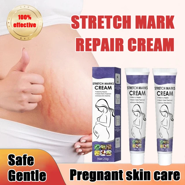 Stretch Mark Repair Cream – Smooth, Firm & Restore Skin Fast