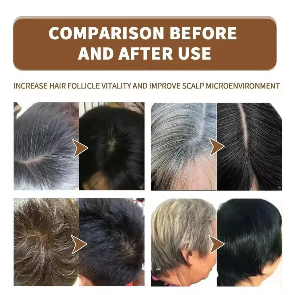 Copertura del siero per il trattamento dei capelli bianchi grigi Capelli bianchi al spray riparatore del colore naturale nero Anti perdita dei capelli Ripristina la salute - immagine 4