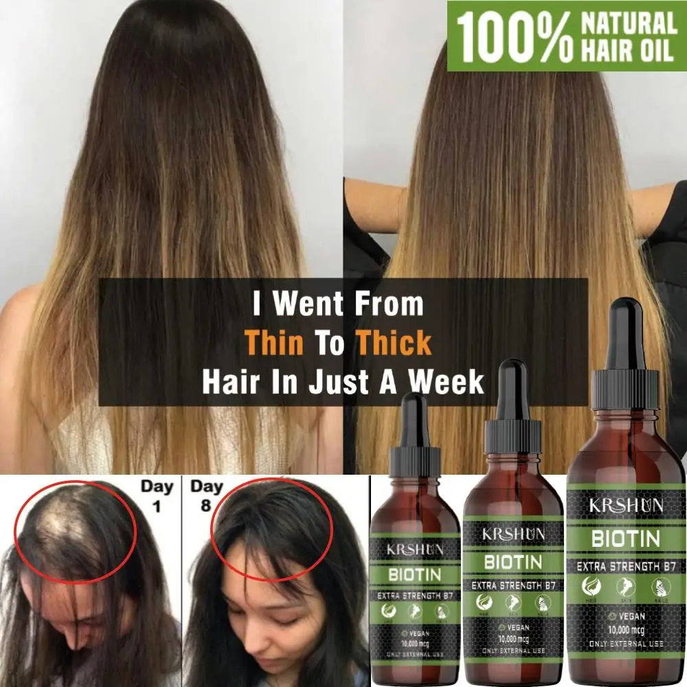 2022 Biotin Fast Hair Growth Oil Hair Regrowth Serum Hair Thinning Treatment  Hair Growth Liquid Anti-hair Loss For Women & Men - Hair Loss Product  Series - AliExpress