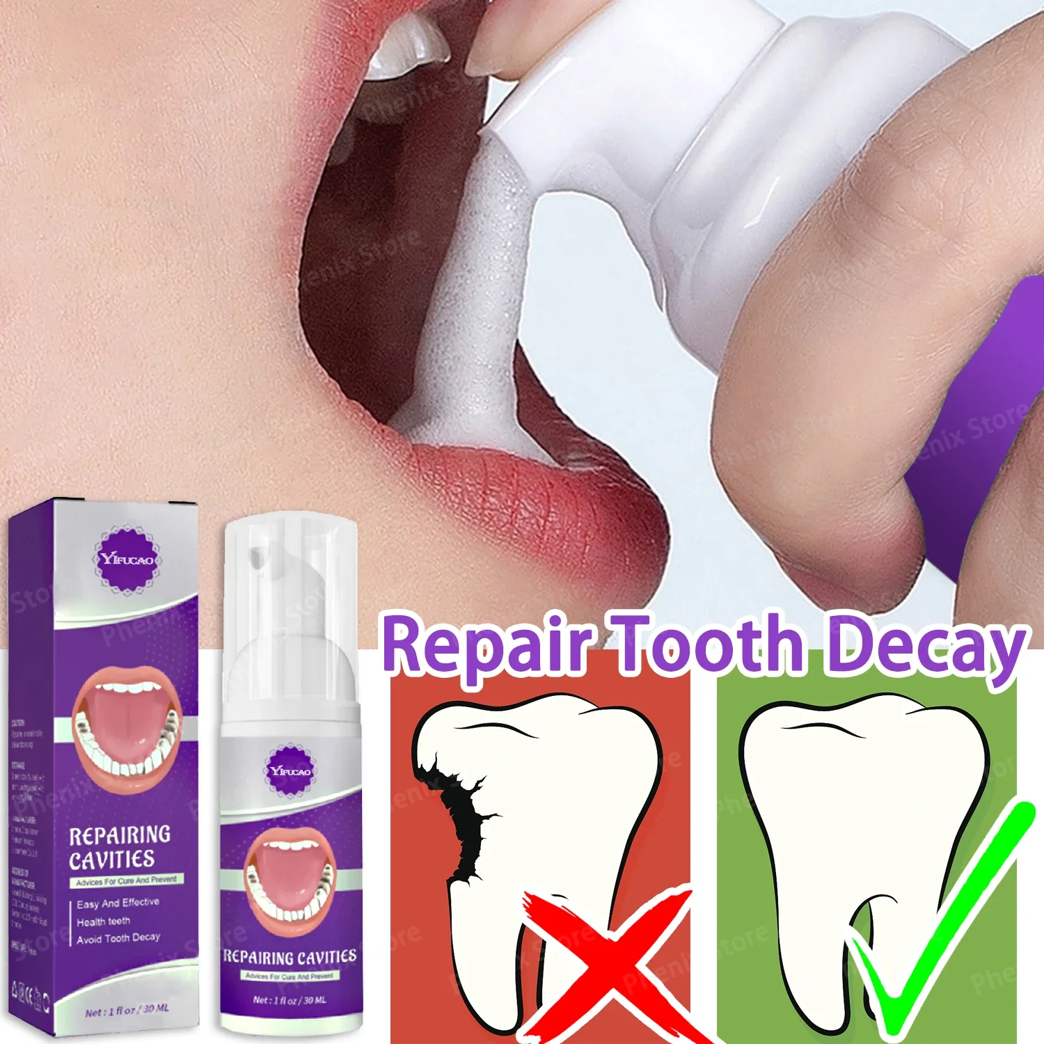 Dental Caries Repair Serum Prevent Tooth Decay Protect Teeth Remove Plaque Oral Cleaning Natural Herbal Extract 30ml gum repair drops