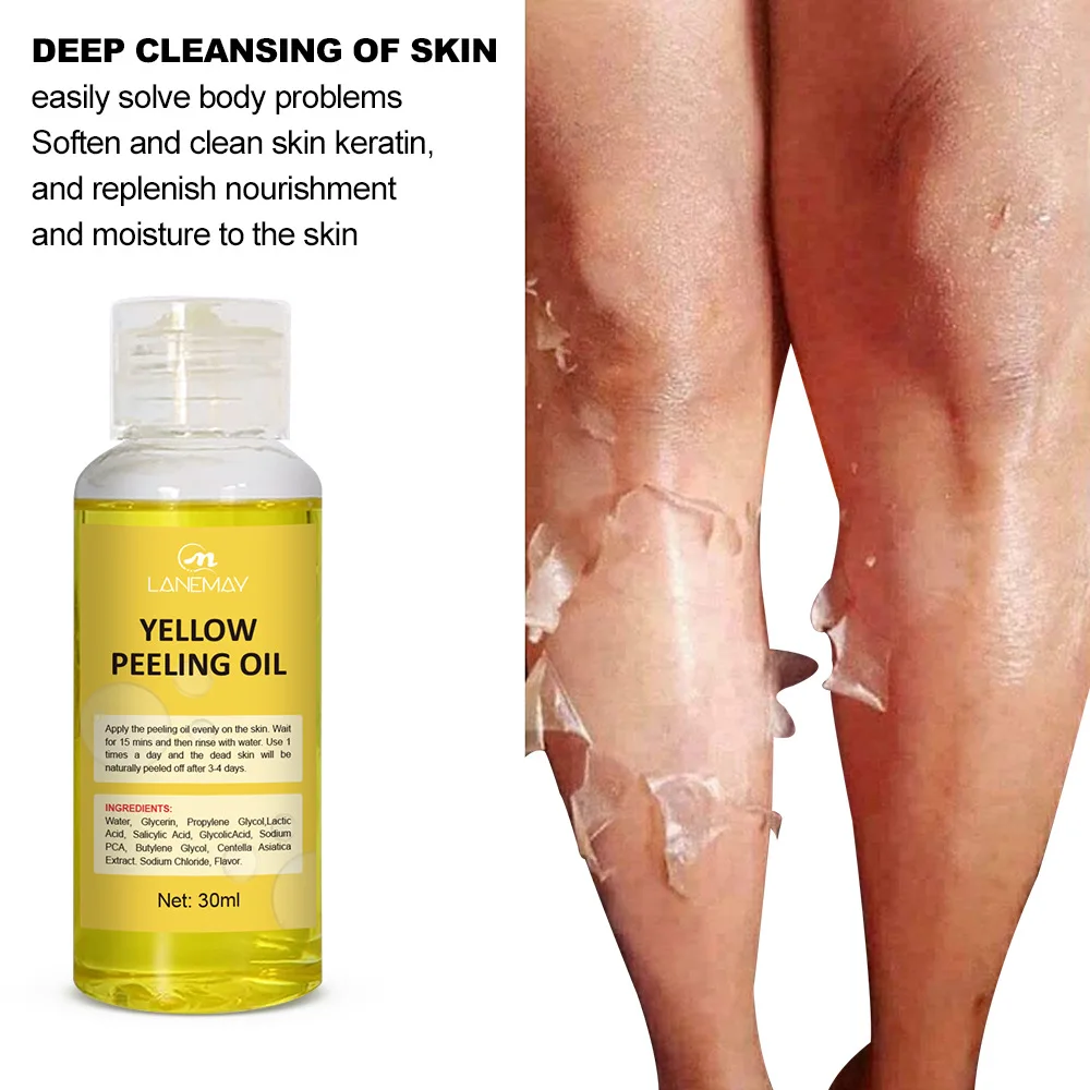 Yellow-Peeling-Oil-Dark-Skin-Bleaching-Remove-Arm-Knee-Legs-Melanin ...