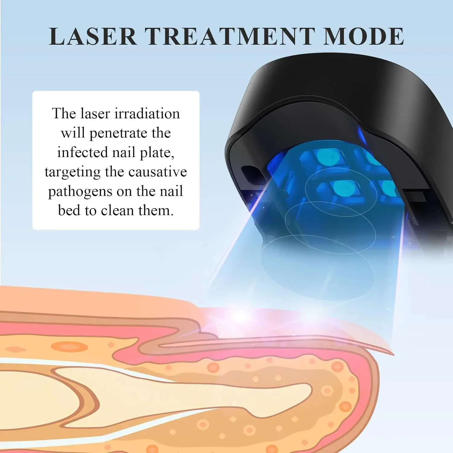 Nail Fungus Remover Laser Therapy Pen Nail Fungus Treatment Laser Device For Cleaning Onychomycosis USB Charge Anti Fungal Repair Damaged Discolored Thick Fingernails