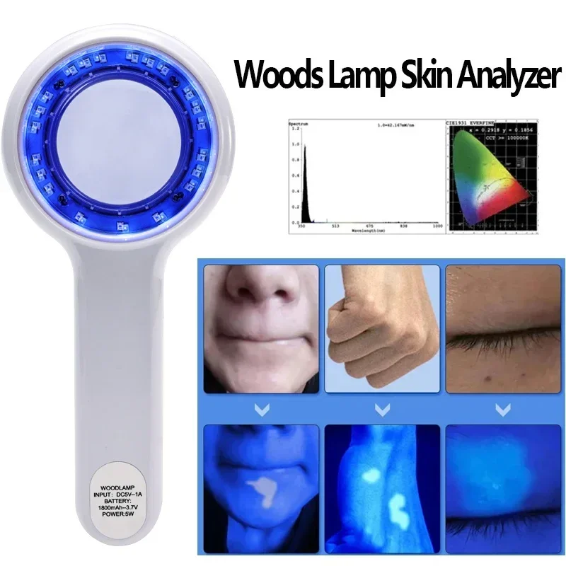 Woods Lamp Skin Analyzer Portable Facial Salon Beauty Analyzer UV Lamp Wood Dermatology for Analyzing Testing Examination