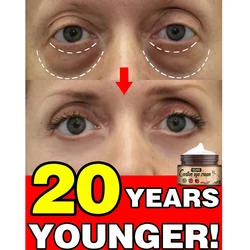 Magical Repair Eye Cream Remove Eye Bags Puffiness Dark Circles Fat Particles Anti Wrinkle Fine Lines Korean Skin Care Products