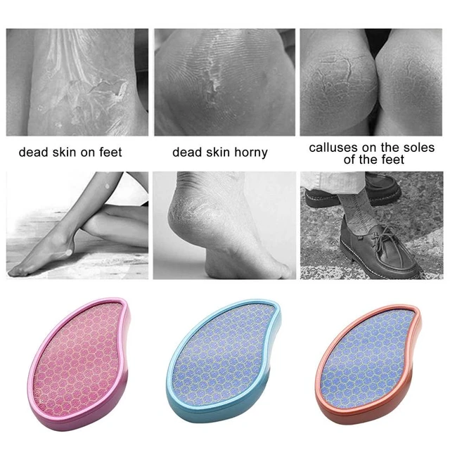 Foot Callus Remover Glass Heel Scraper Glass Callus Remover Foot File For Feet  Heel Scraper For Cracked Heels Repair For - AliExpress