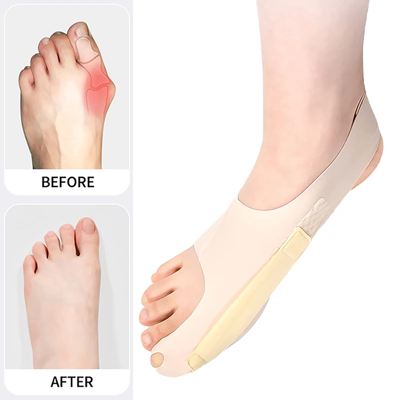 1 Pcs Big Toe Protector Adjust Unisex Soft Pedicure Socks For Bunions Hallux Valgus Orthopedic Bandage Foot Care Toe Correction