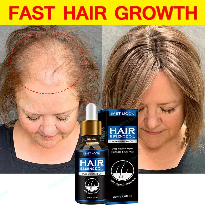 

Biotin Hair Growth Products for Men Women Anti Hair Loss Fast Regrowth Thicken Oils Scalp Treatment Serum Hair Care