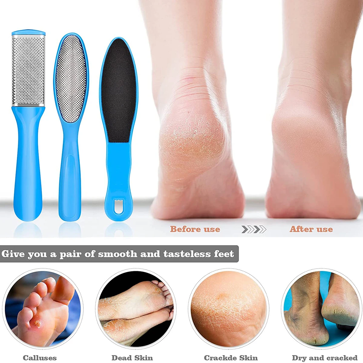 Foot Scraper Pedicure Supplies for Dead Skin Heel File Like Grater Calusses  Remover Feet Callus Shaver Feet Scrubber Hard Skin Kit with 10 Blade