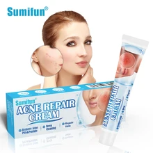 

20G Sumifun Acne Cream Herbal Anti-Acne Essence Acne Pimple Treatment Ointment Moisturizing Nourishing Repair Skin Beauty Health