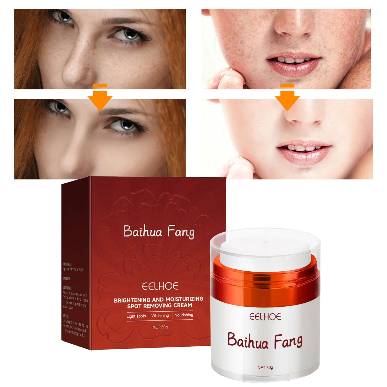 

Whitening Freckle Cream Remove Dark Spots Anti Freckle Niacinamide Fade Pigmentation Melasma Improve Dullness Brighten Skin Care