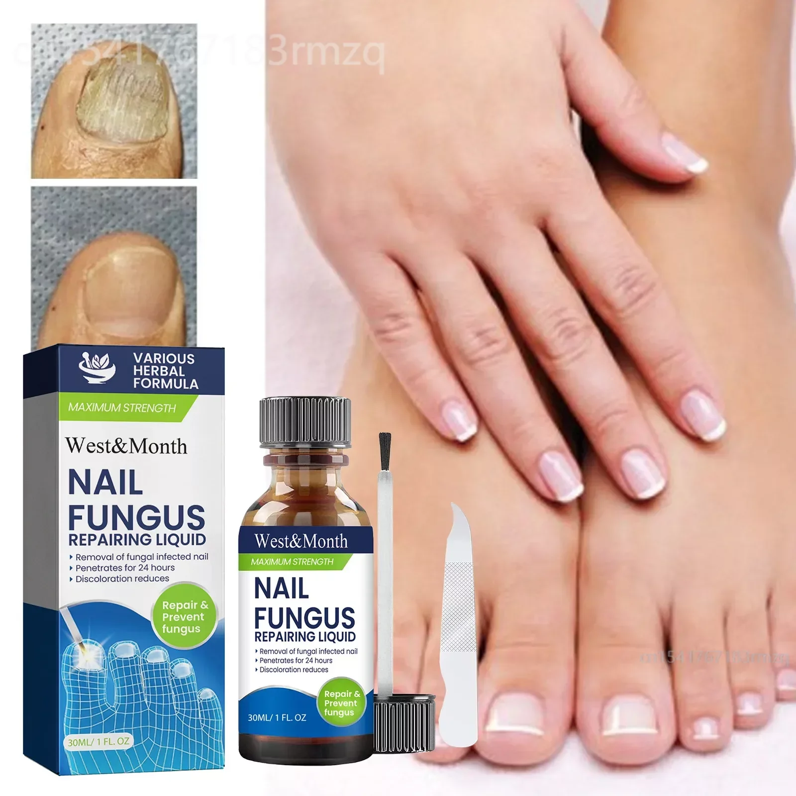 30ML Fungal Nail Treatment Removal Oil Foot Fungus Repair Essence Toe Fungus Removal Gel Anti Infection Best Essenice 발톱무좀