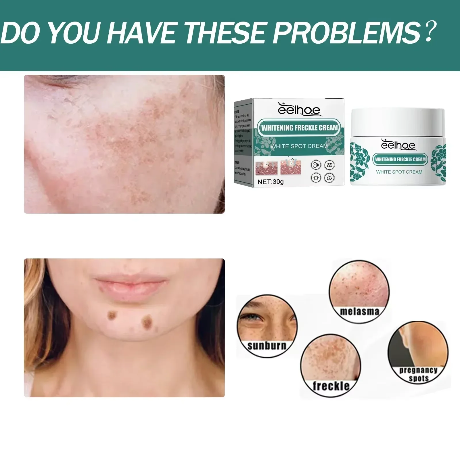 Chloasma & Fine Line Serum 3