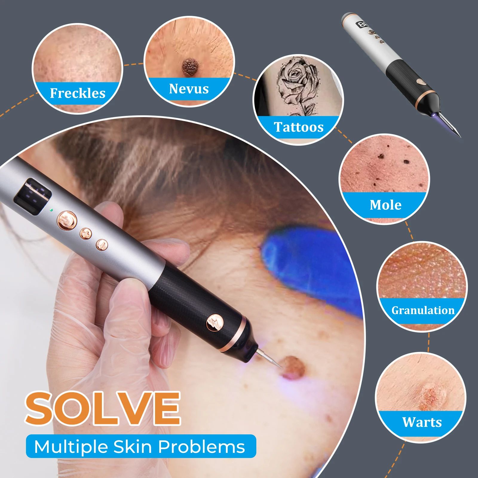 Laser Plasma Pen 15 Level Black Dots Mole Wart Remover Pen Dark Spot Remover For Face Blemish Removal Laser Skin Tag Removal