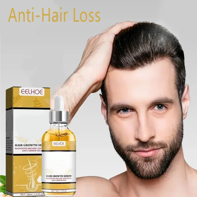 Haaröl-Reparatur, erblicher Haarausfall, postpartale seborrhoische Haarausfall-Ölpflege, Anti-Haarausfall