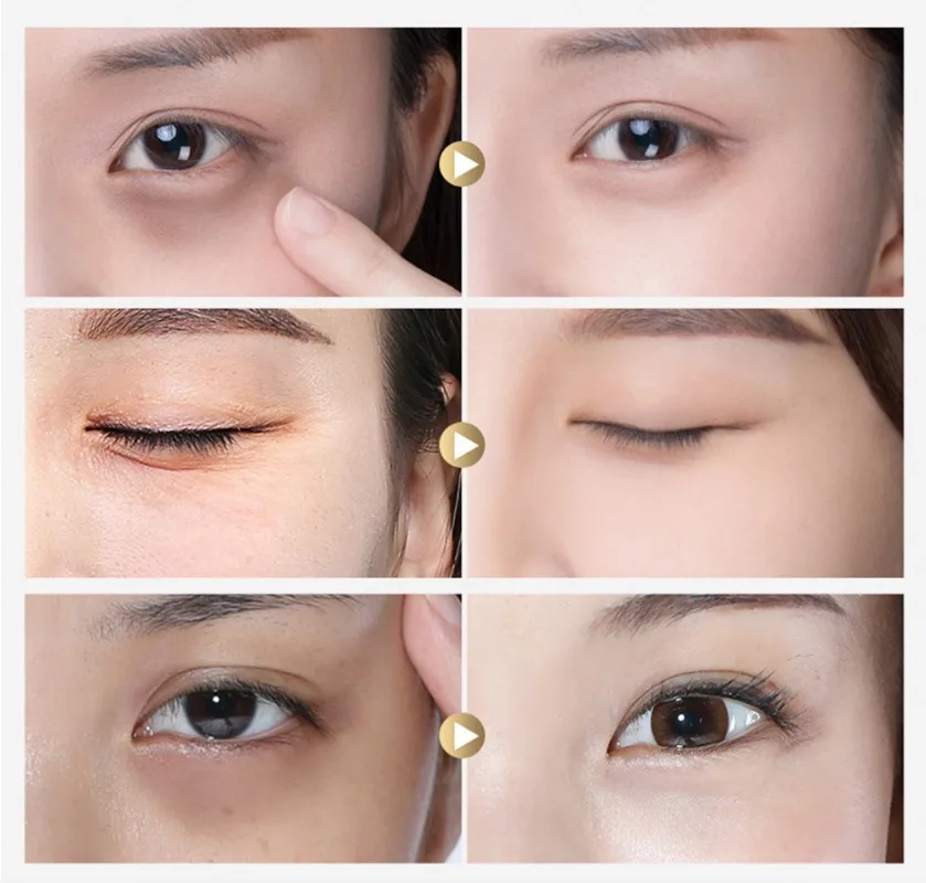 Collagen Eye Patches Moisturizing Firming Reducing Dark Circles Fine Lines Eye Mask Retinol VC Eyes Pads Sleep Eyes Care Expert 2