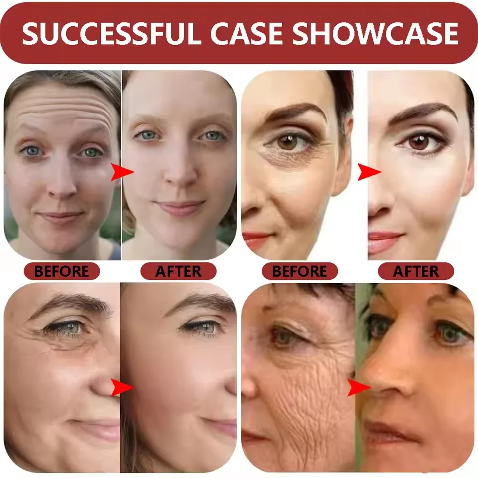 Ginseng Snail Serum Anti Wrinkle Aging Eye Face Lift Tightening Moisturising Smooth Fine Lines Brighten Korean Cosmetics 30ML 5