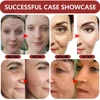 Ginseng Snail Serum Anti Wrinkle Aging Eye Face Lift Tightening Moisturising Smooth Fine Lines Brighten Korean Cosmetics 30ML 5