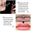 Remove Dark Lip Balm Fast Lightening Pink Lip Exfoliating Fade Lip Line Dead Skin Moisturizer Korean Care Products Beauty Health 6
